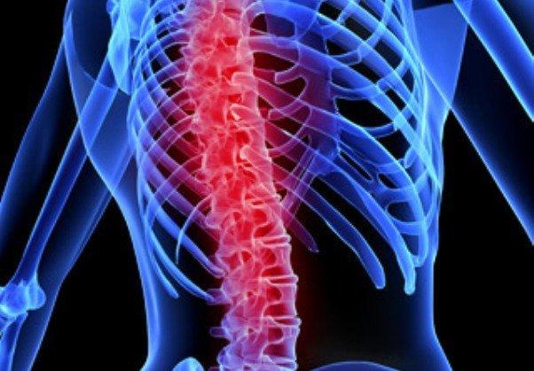 افزایش ابتلا به پیری ستون فقرات، ارائه روش های جدید درمانی