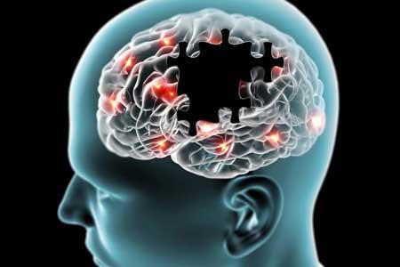 کلسترول مغز پلاک های آلزایمر را تنظیم می نماید
