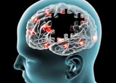 کلسترول مغز پلاک های آلزایمر را تنظیم می نماید